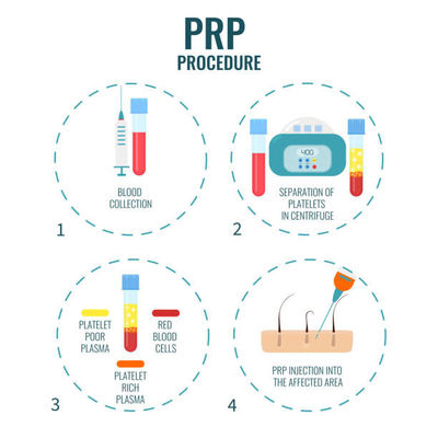 Harga yang bagus Veterinary Medicine:** Process animal blood for PRP therapies in equine and canine sports medicine. on line